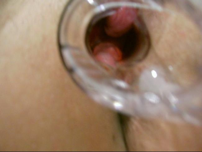 speculum in pussy